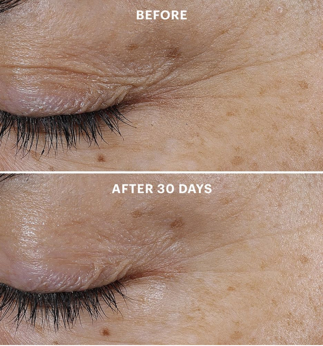 Bio-Renew EGF Eye Cream